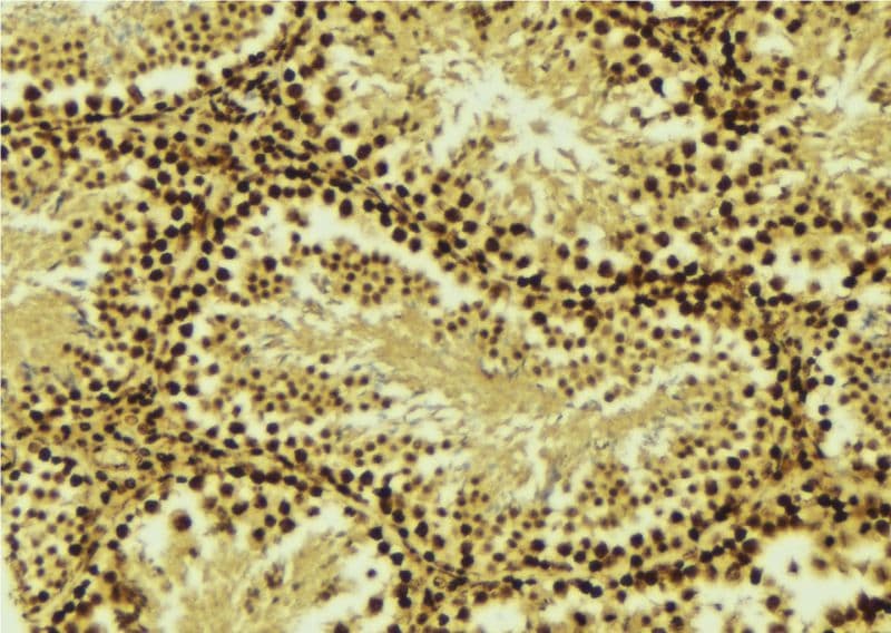 CRADD / RAIDD Antibody