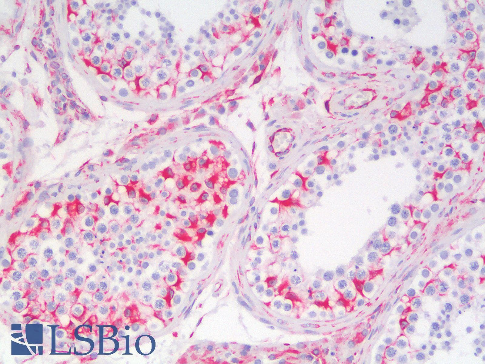 PathPlus™ Polyclonal Rabbit anti-Mouse Vimentin Antibody (IHC, WB)