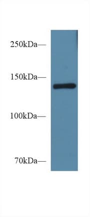 SEMA4D / Semaphorin 4D / CD100 Antibody (aa502-636)