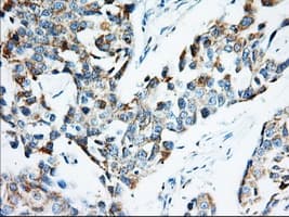 IGF2BP2 Antibody (clone OTI3F9)