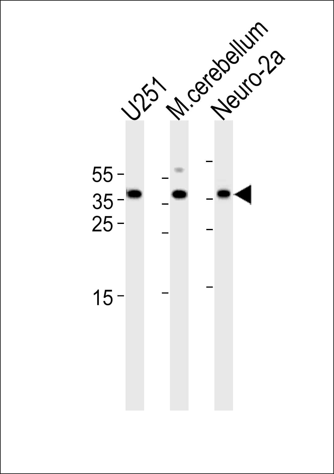 IHC-plus™ EMX1 Antibody (aa228-257)
