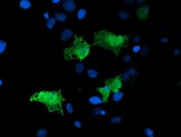 ARH / LDLRAP1 Antibody (clone OTI7E11)