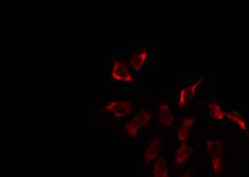 Polyclonal Rabbit anti-Human Sma3 Antibody (IF, WB)