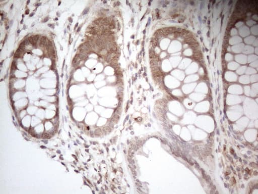 AAAS / Adracalin Antibody (aa322-546, clone OTI7H7, Carrier-free)