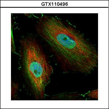 Polyclonal Rabbit anti-Human BIVM Antibody (aa439-503, IHC, WB)