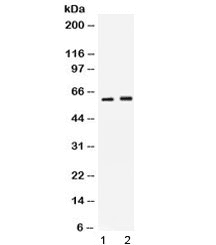 SCTR / SR / Secretin Receptor Antibody