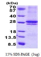 Human CRLF2 / TSLPR Protein (Recombinant His)