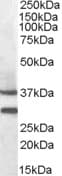 IHC-plus™ MC5R / MC5 Receptor Antibody (aa24-35)