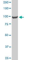 CTDP1 / FCP1 Antibody (clone 3G4)