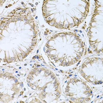 HPS / HPS1 Antibody