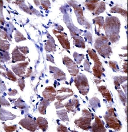 Polyclonal Rabbit anti-Human DPYSL3 / CRMP4 Antibody (aa461-490, IHC, WB)