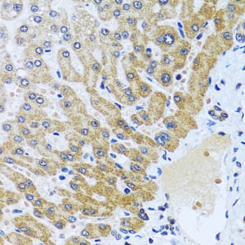 CPA6 / Carboxypeptidase A6 Antibody