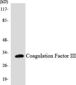 F3 / CD142 / Tissue factor Antibody (aa237-286)