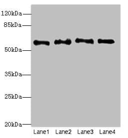 Polyclonal Rabbit anti-Human NMT2 Antibody (IHC, WB)