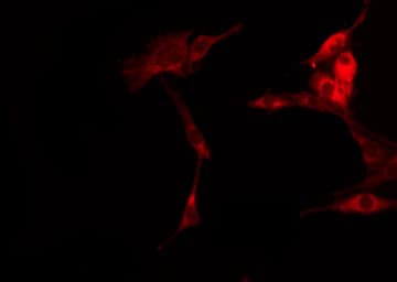 LIMK1 / LIMK Antibody
