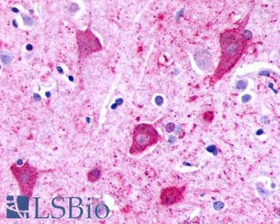 PathPlus™ Polyclonal Rabbit anti-Human P2RY8 / P2Y8 Antibody (Cytoplasmic Domain, IHC)