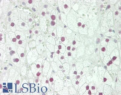 IHC-plus™ Polyclonal Rabbit anti-Human PRMT1 Antibody (aa1-50, IHC, WB)
