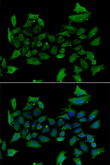 Polyclonal Rabbit anti-Human ALAS1 Antibody (aa1-250, IHC, IF, WB)
