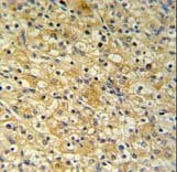 Polyclonal Rabbit anti-Human TSC501 / NAT8 Antibody (aa110-138, IHC, WB)