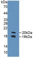 NRG1 / Heregulin / Neuregulin Antibody (aa264-393)