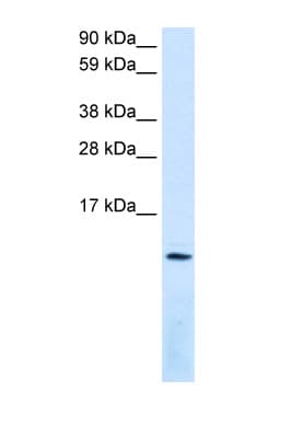 Polyclonal Rabbit anti-Human SDF1 / CXCL12 Antibody (C-Terminus, IHC, WB)