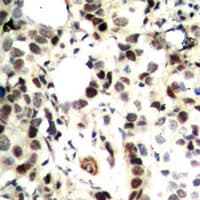 CHEK2 / CHK2 Antibody (Internal)