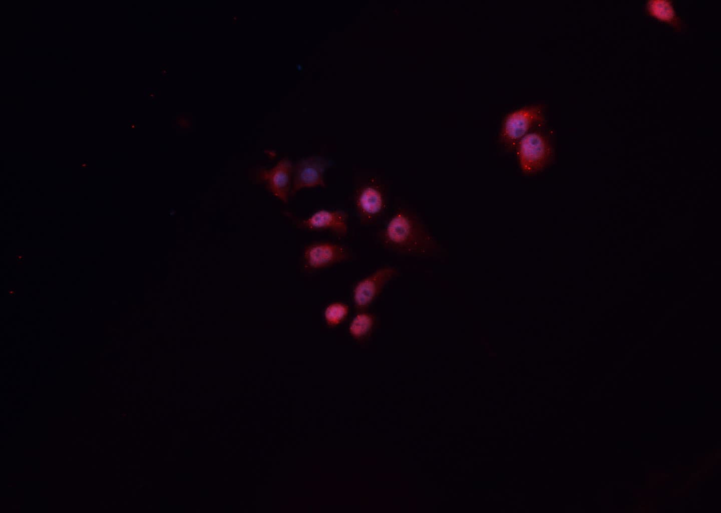 HNF1B / HNF1 Beta Antibody