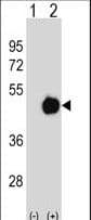 PME-1 / PPME1 Antibody (aa351-379)