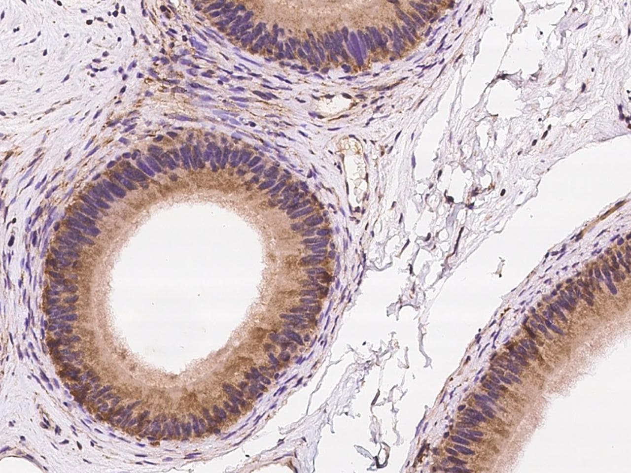 ZNF599 Antibody