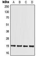 Polyclonal Rabbit anti-Human MED30 Antibody (Internal, WB)