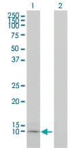 Apolipoprotein C-I Antibody (clone 2E2-1A3)
