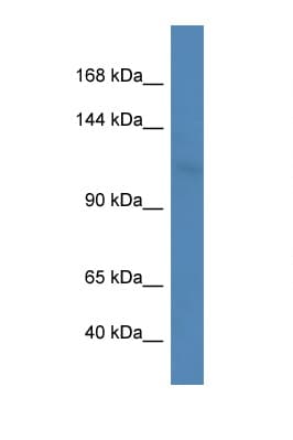 LIG3 / DNA Ligase III Antibody (aa220-269)