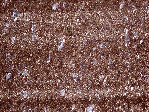Monoclonal Mouse anti-Human PRRT2 Antibody (clone OTI9H8, aa152-268, IHC, WB)