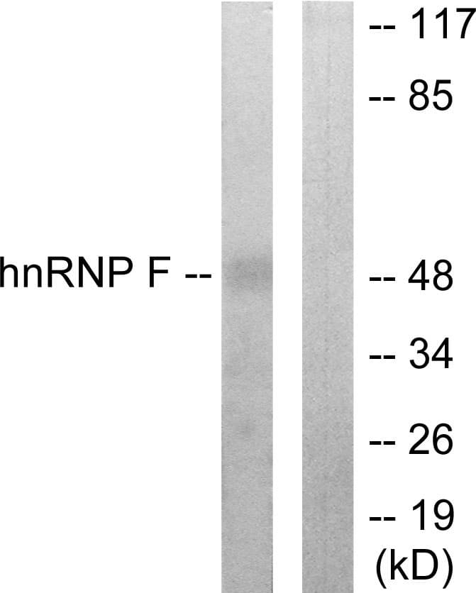 HNRNPF / hnRNP F Antibody (aa11-60)