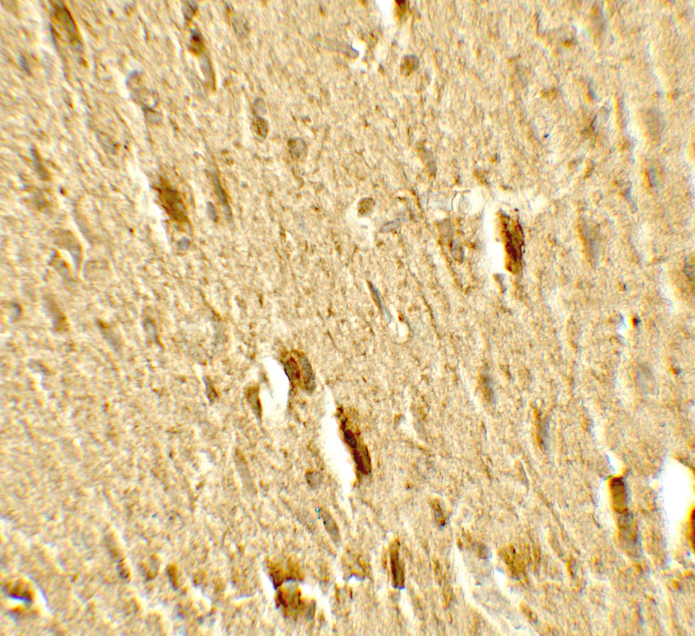 Mitofusin 2 / MFN2 Antibody