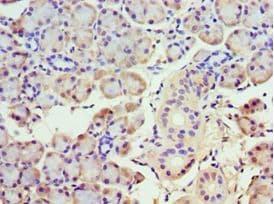 ABHD5 Antibody (aa1-349)