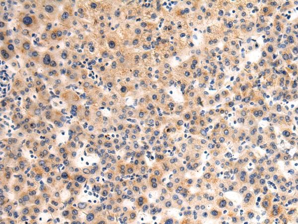 Polyclonal Rabbit anti-Human GLT8D1 Antibody (IHC)