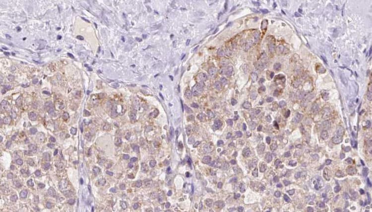USP33 / VDU1 Antibody