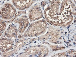 TUBAL3 Antibody (clone OTI1C2)