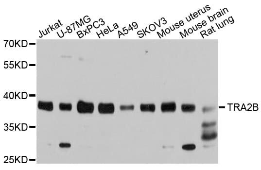 TRA2B / SFRS10 Antibody