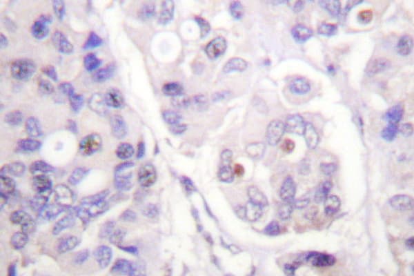 APC6 / CDC16 Antibody (Lys556)