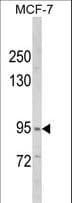 HCCS1 / VPS53 Antibody (aa111-140)