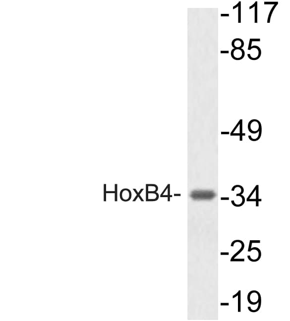 HOXB4 Antibody (Ala135)