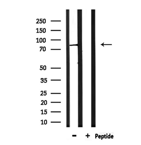 Polyclonal Rabbit anti-Human PIGQ Antibody (IF, WB)