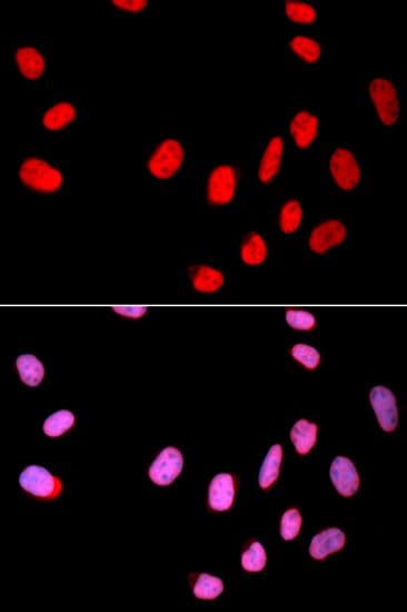 CDC25C Antibody