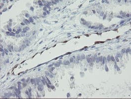 RBPMS / Hermes Antibody (clone OTI3B7)