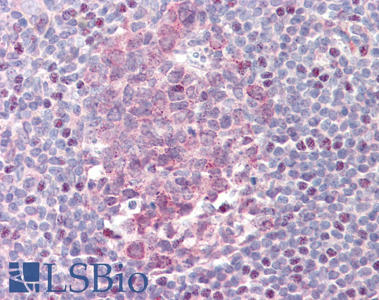 IHC-plus™ BCL6 Antibody
