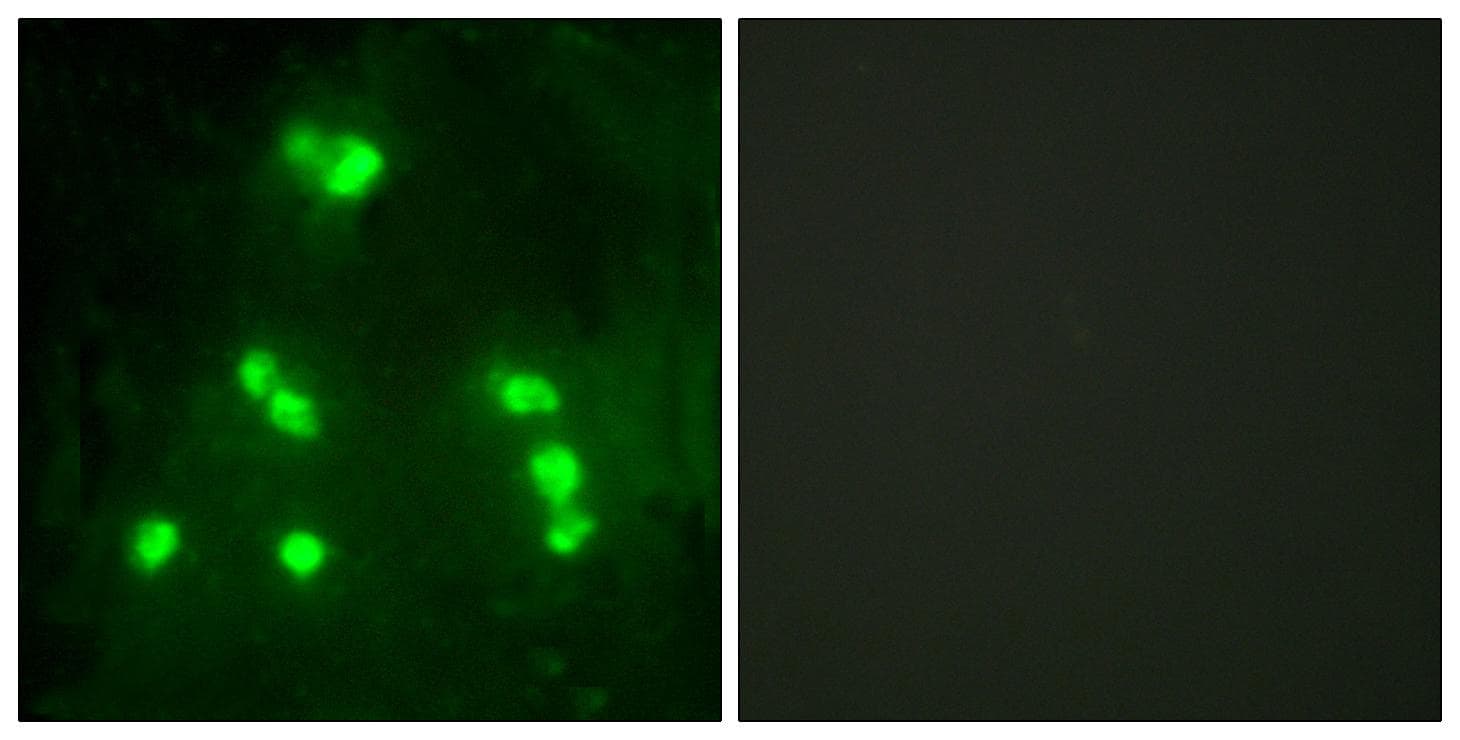 Hairless / HR Antibody