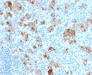 CD30 Antibody (clone SPM121)
