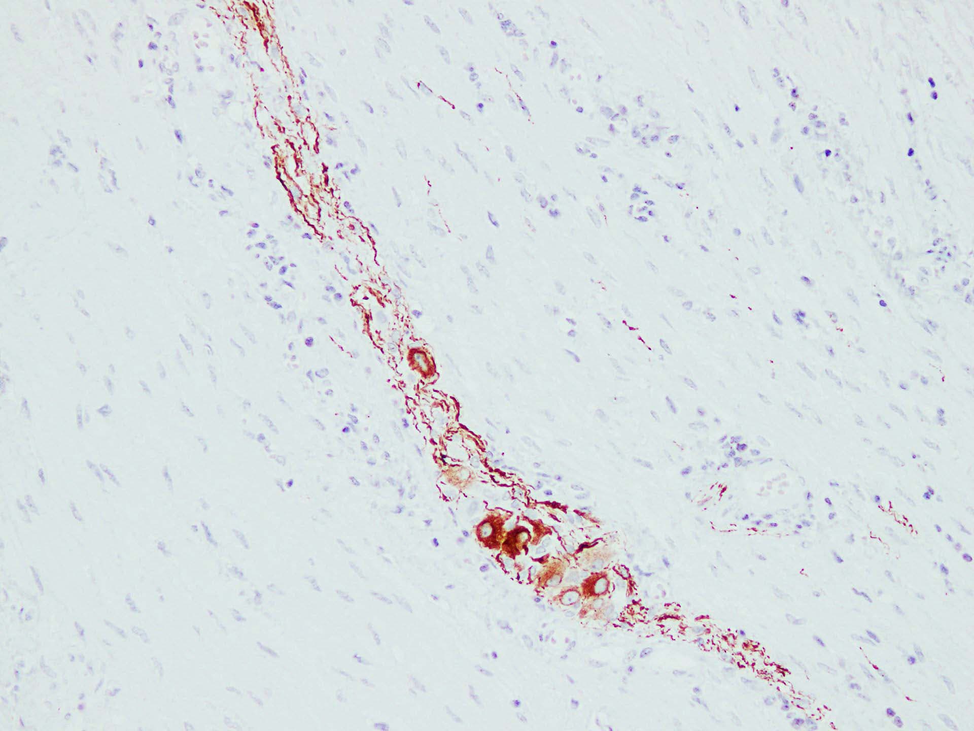NF-L / NEFL Antibody (clone ABT-NF)